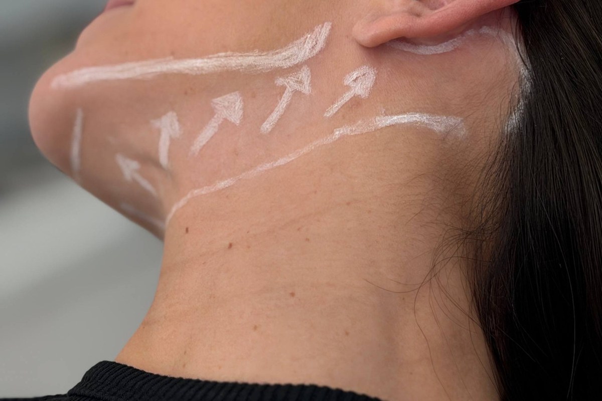 Lipo Cervical — Dr. Niro Reis