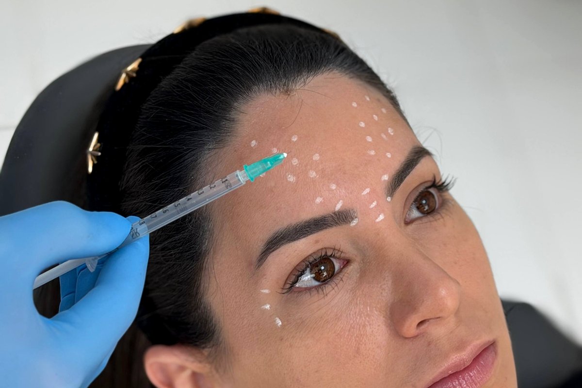 Toxina Botulínica Botox — Dr. Niro Reis